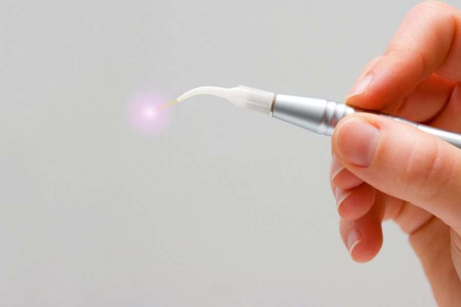 dental laser